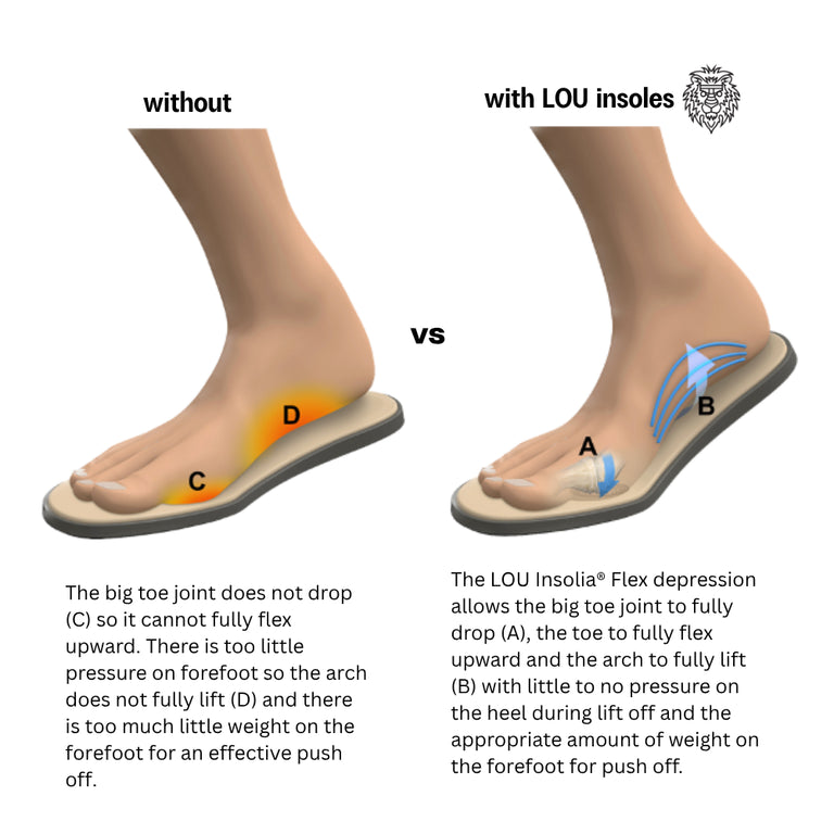 LOU Sport Insole